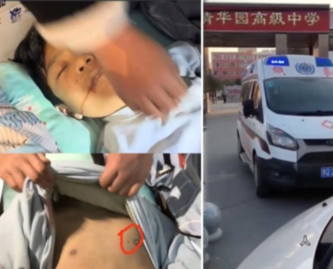 河南男生離奇死亡 身體驚現釘子孔 校方搶屍 武警鎮壓家長